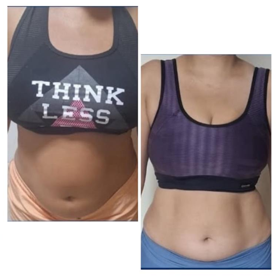 Antes e depois da barriga
