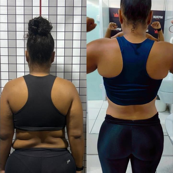 Antes e depois das costas