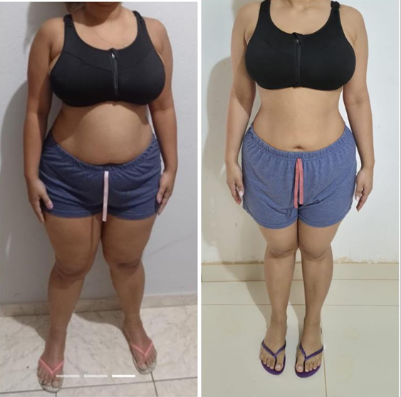 Antes e depois de frente